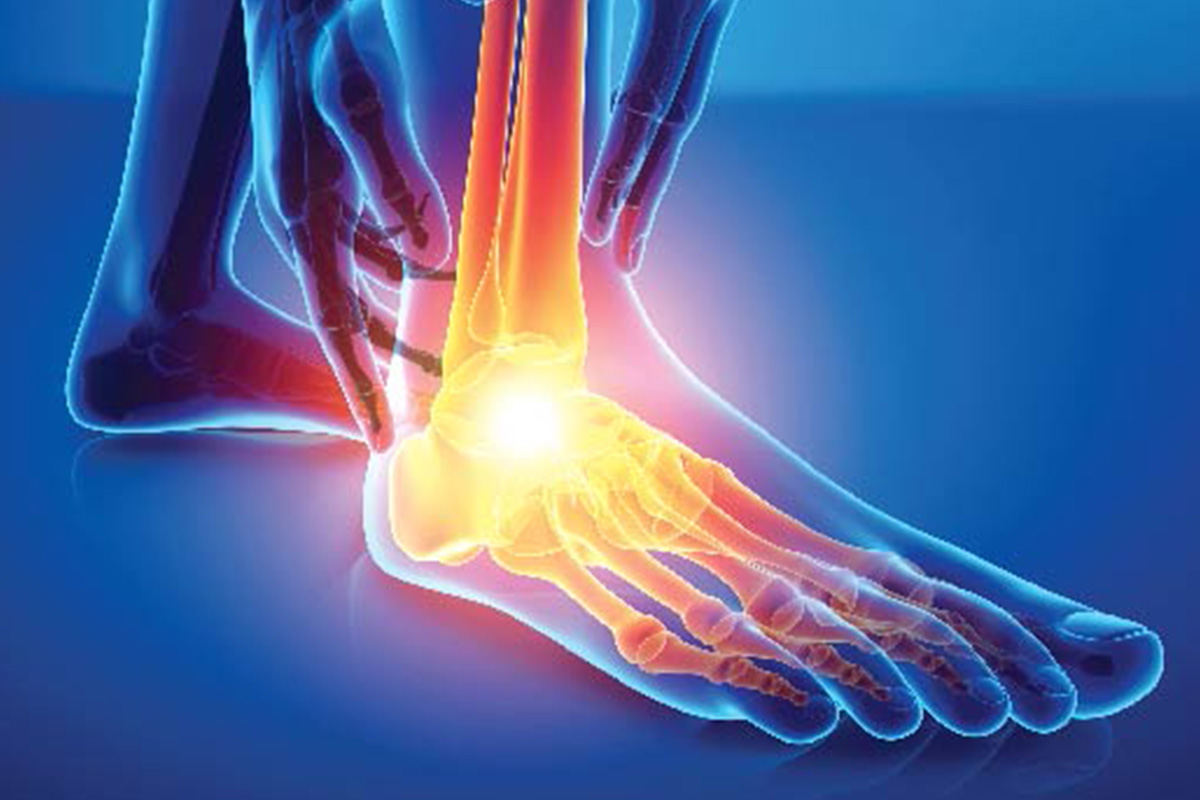 Foot & Ankle Surgery - Kutch Orthopaedic Hospital